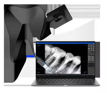 High Quality APS CMOS Dental RVG Digital Intraoral Imaging X Ray Sensor